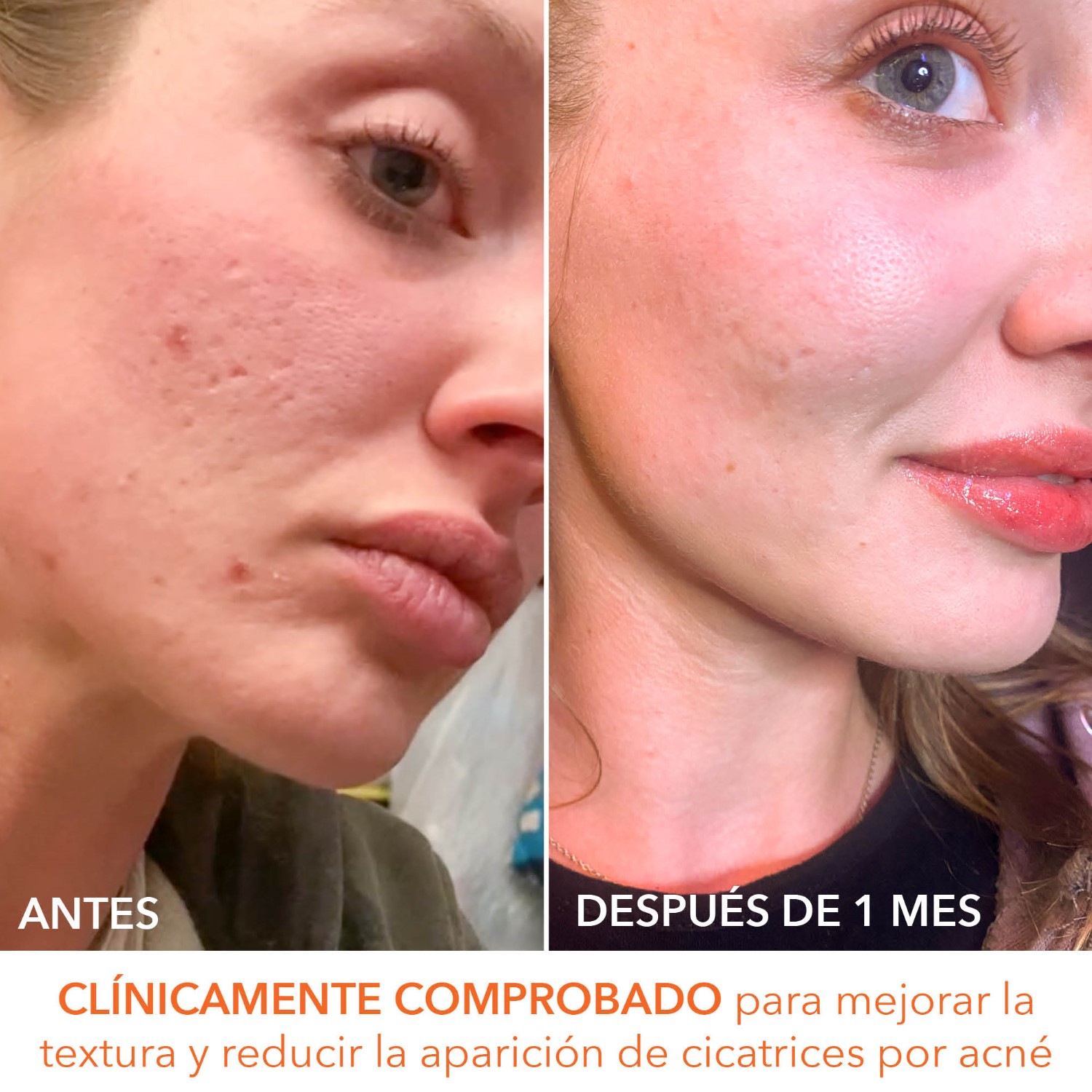 ALPHA BETA EXTRA STRENGTH DAILY PEEL  (ALMOHADILLAS EXFOLIANTES DIARIAS EXTRAFUERTES)